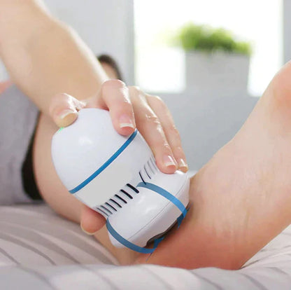 AuraCollective Vacuum Callus Remover