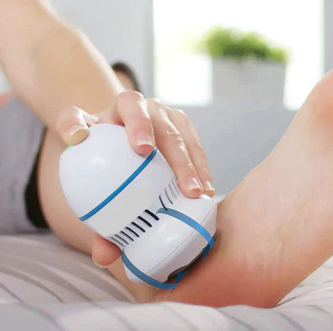 AuraCollective Vacuum Callus Remover